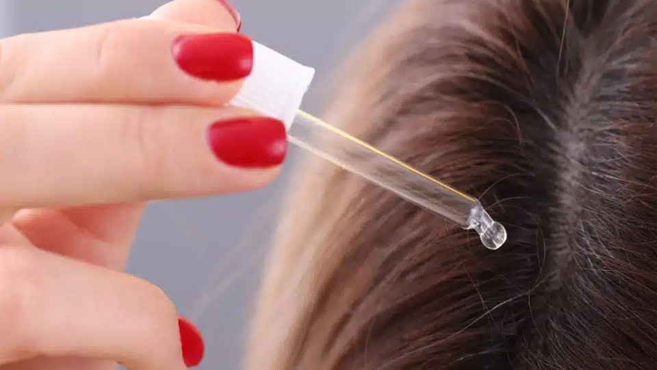 Minoxidil vs. Minoxidil Sulfate