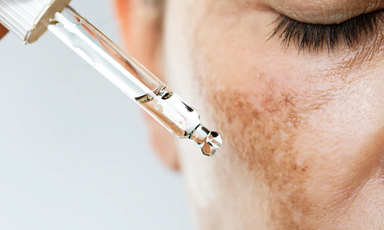 Tranexamic Acid Applications